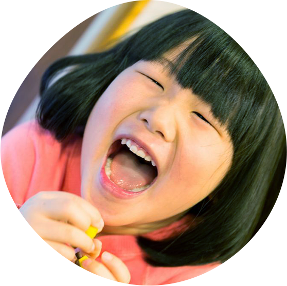 マウスピースなので取り外し可能痛みや嫌な思いをしづらい